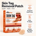 Skin Tag Removal Patch | Easy-to-Use Skin Tag Care Patches | Buy 1 Get 1 Free